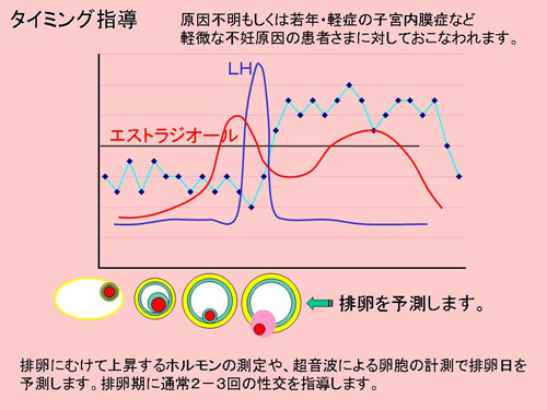 タイミング指導図解