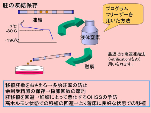受精卵（胚）の凍結保存図解