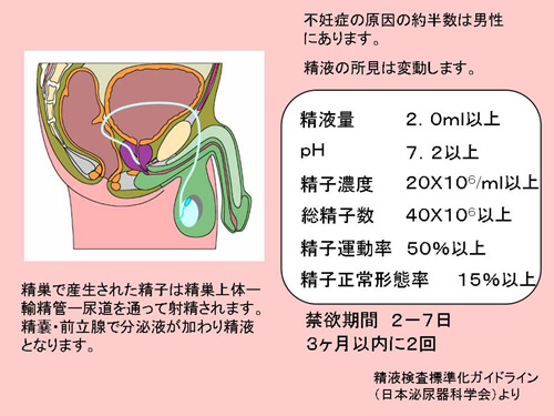 男性側の検査図解